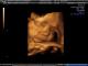 Avatar de ainhoalucia