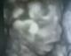 Avatar de mamiHugo