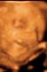 Avatar de Nerissa